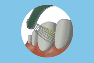 বুলেটেডান প্রযুক্তি